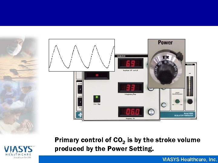 Primary control of CO 2 is by the stroke volume produced by the Power