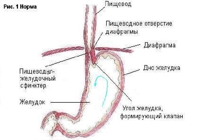 Пищевод обозначен на рисунке. Грыжа пищеводного отверстия диафрагмы анатомия. Диафрагма пищевода строение. Пищеводное отверстие диафрагмы норма.