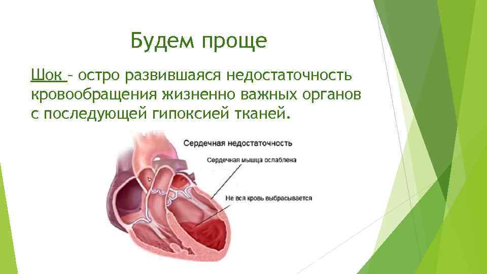 Будем проще Шок – остро развившаяся недостаточность кровообращения жизненно важных органов с последующей гипоксией