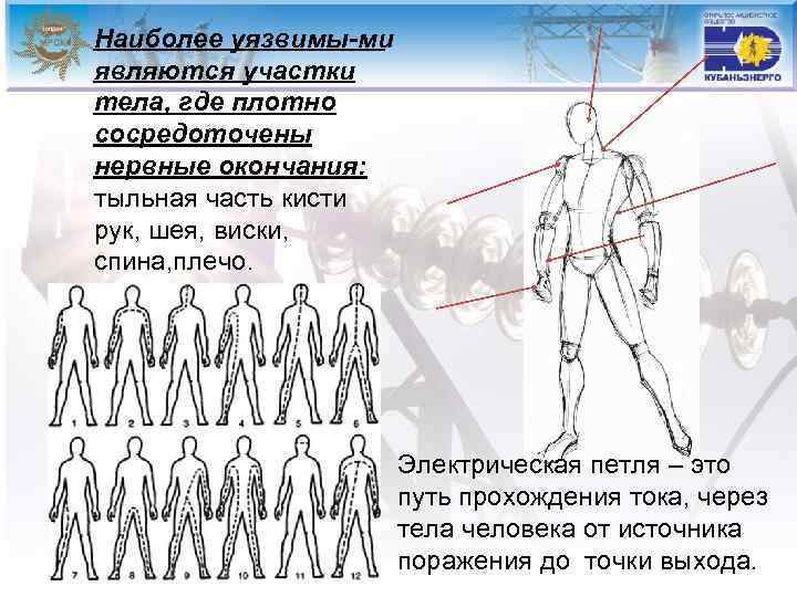 Наиболее уязвимы ми являются участки тела, где плотно сосредоточены нервные окончания: тыльная часть кисти