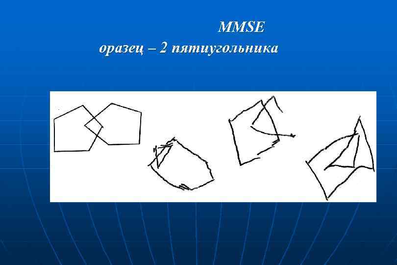 MMSE оразец – 2 пятиугольника 