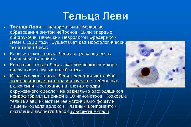 Тельца Леви n n Тельца Леви — ненормальные белковые образования внутри нейронов. Были впервые