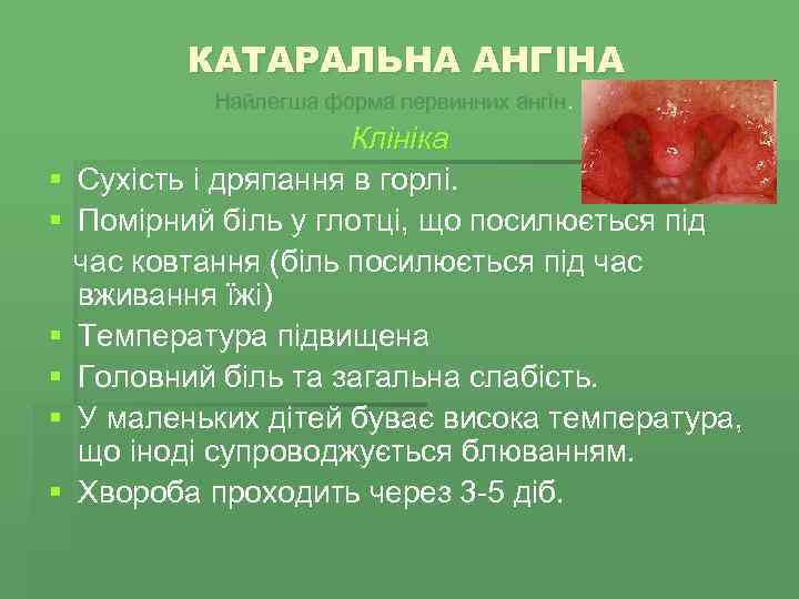 КАТАРАЛЬНА АНГІНА Найлегша форма первинних ангін. § § § Клініка Сухість і дряпання в