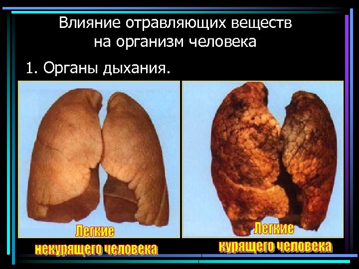 Влияние отравляющих веществ на организм человека 1. Органы дыхания. 
