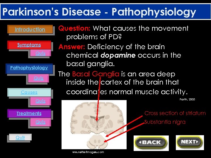 Parkinson’s Disease - Pathophysiology Introduction Symptoms Quiz Pathophysiology Quiz Causes Question: What causes the