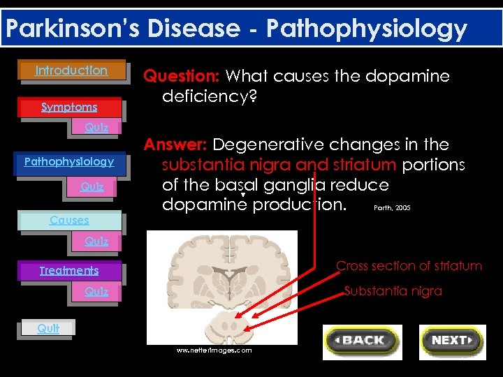 Parkinson’s Disease - Pathophysiology Introduction Symptoms Quiz Pathophysiology Quiz Causes Question: What causes the