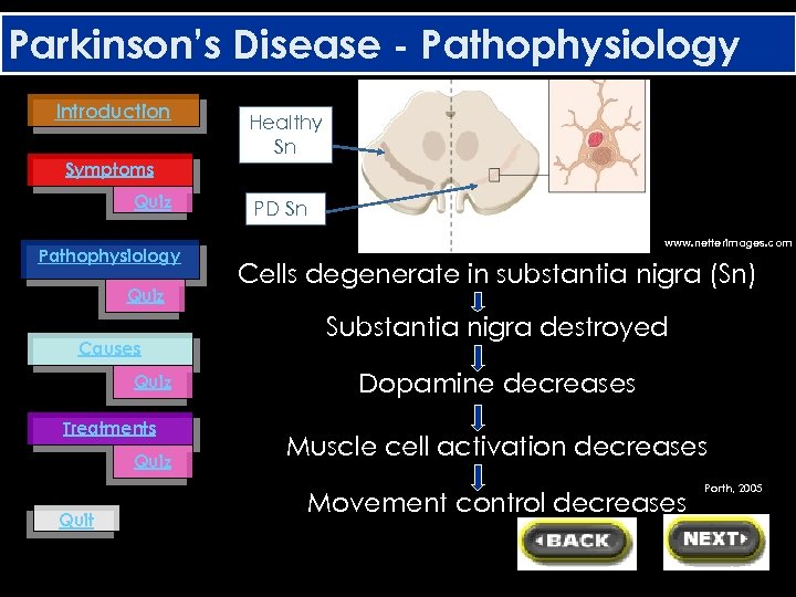 Parkinson’s Disease - Pathophysiology Introduction Healthy Sn Symptoms Quiz Pathophysiology Quiz Causes Quiz Treatments