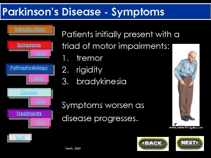 Parkinson’s Disease - Symptoms Introduction Symptoms Quiz Pathophysiology Quiz Patients initially present with a