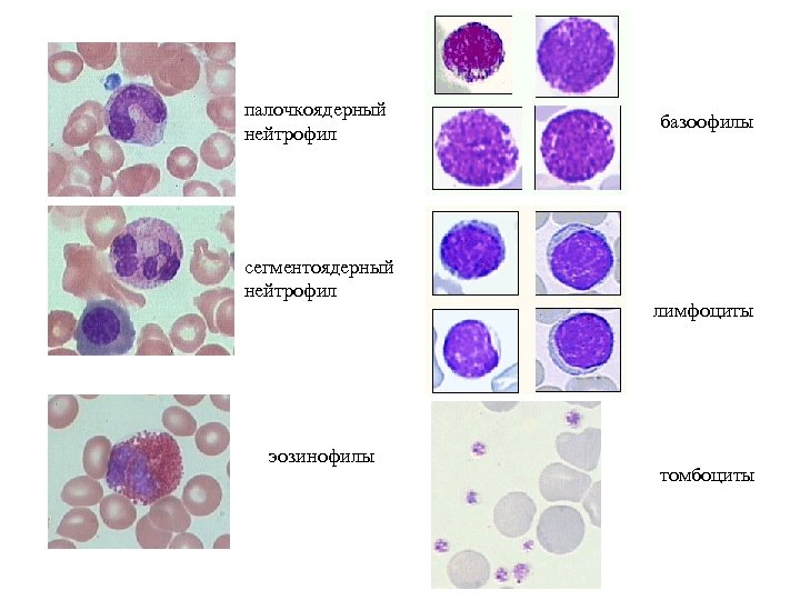 Палочкоядерные нейтрофилы картинки