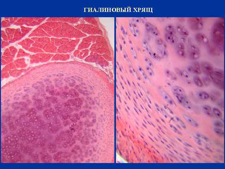 Гиалиновый хрящ рисунок