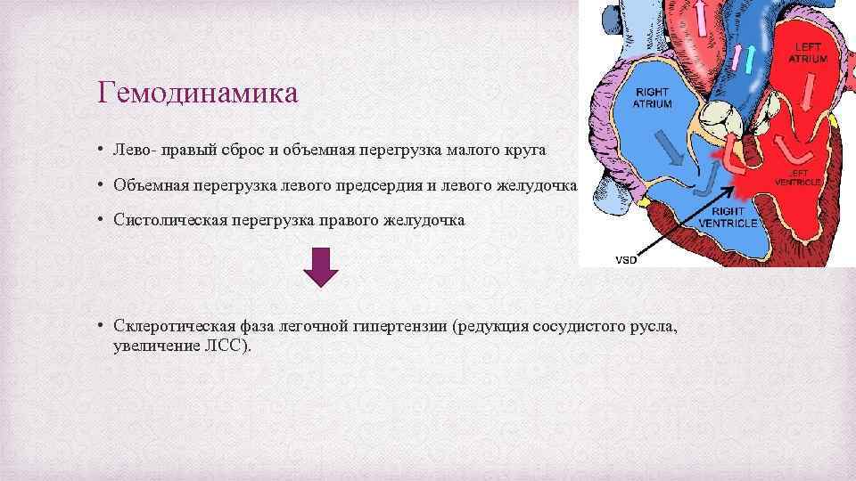 Лево право сброс. Систолическая перегрузка правого желудочка. Объемная перегрузка правого желудочка. Перегрузка левого желудочка давлением развивается при. Перегрузка правого желудочка развивается при.