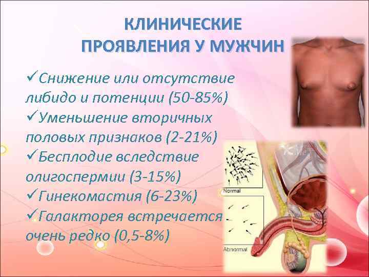 КЛИНИЧЕСКИЕ ПРОЯВЛЕНИЯ У МУЖЧИН üСнижение или отсутствие либидо и потенции (50 -85%) üУменьшение вторичных