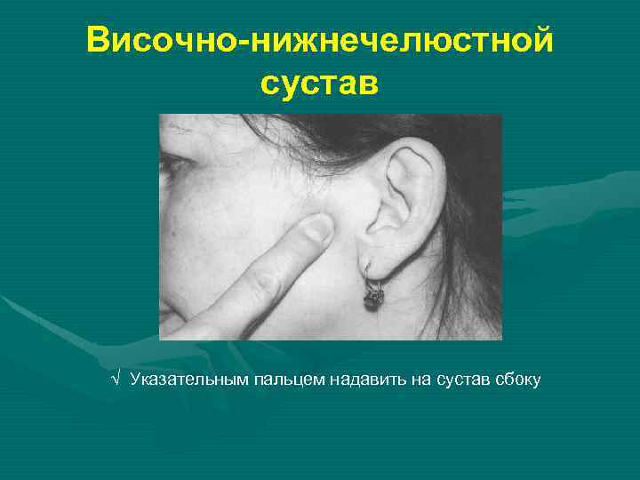 Височно-нижнечелюстной сустав √ Указательным пальцем надавить на сустав сбоку 