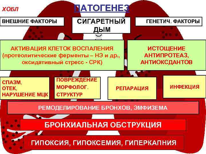 Схема патогенеза хобл