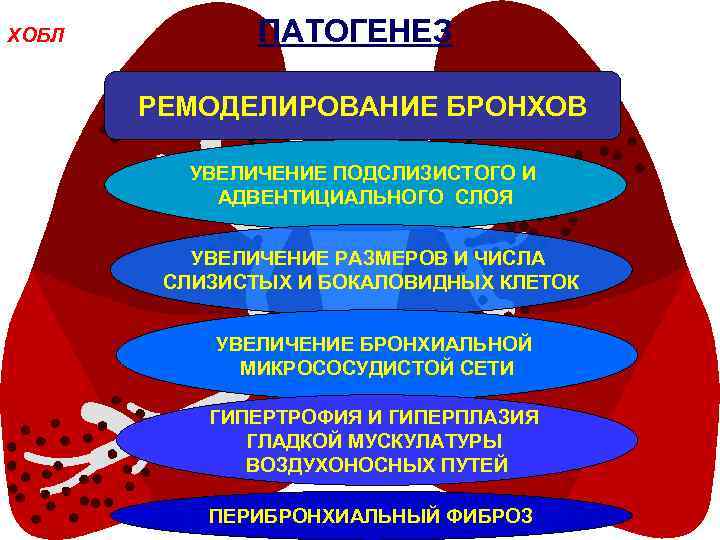 ХОБЛ ПАТОГЕНЕЗ РЕМОДЕЛИРОВАНИЕ БРОНХОВ УВЕЛИЧЕНИЕ ПОДСЛИЗИСТОГО И АДВЕНТИЦИАЛЬНОГО СЛОЯ УВЕЛИЧЕНИЕ РАЗМЕРОВ И ЧИСЛА СЛИЗИСТЫХ