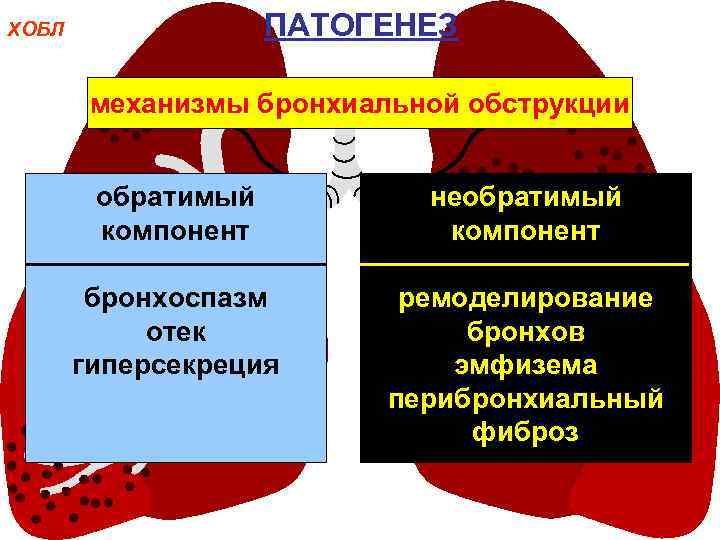 ПАТОГЕНЕЗ ХОБЛ механизмы бронхиальной обструкции обратимый компонент необратимый компонент бронхоспазм отек гиперсекреция ремоделирование бронхов