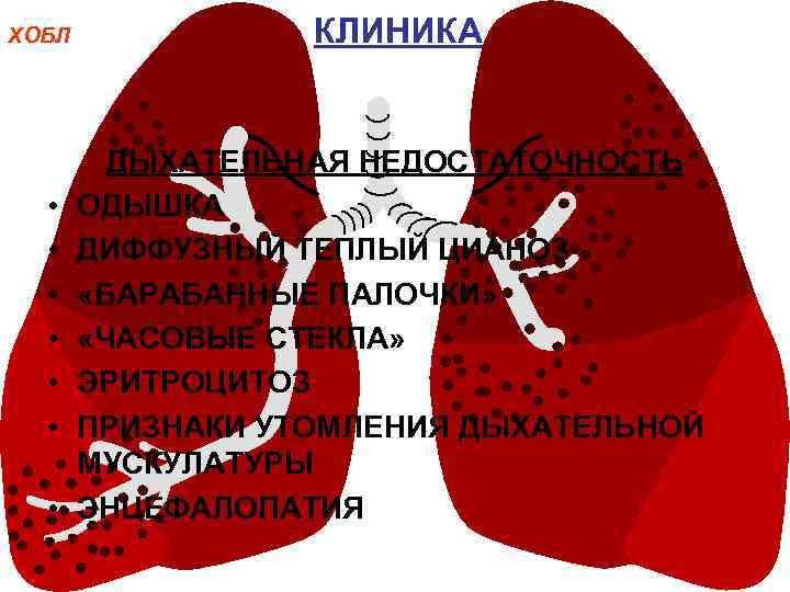 ХОБЛ • • КЛИНИКА ДЫХАТЕЛЬНАЯ НЕДОСТАТОЧНОСТЬ ОДЫШКА ДИФФУЗНЫЙ ТЕПЛЫЙ ЦИАНОЗ «БАРАБАННЫЕ ПАЛОЧКИ» «ЧАСОВЫЕ СТЕКЛА»