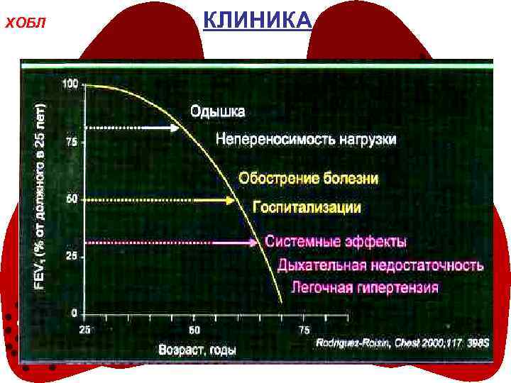 ХОБЛ КЛИНИКА 