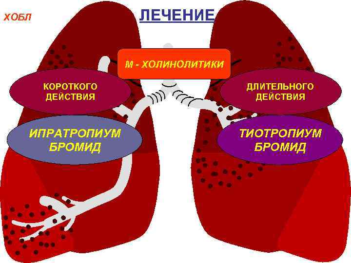 ЛЕЧЕНИЕ ХОБЛ М - ХОЛИНОЛИТИКИ КОРОТКОГО ДЕЙСТВИЯ ИПРАТРОПИУМ БРОМИД ДЛИТЕЛЬНОГО ДЕЙСТВИЯ ТИОТРОПИУМ БРОМИД 