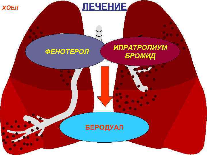 ХОБЛ ЛЕЧЕНИЕ ФЕНОТЕРОЛ ИПРАТРОПИУМ БРОМИД БЕРОДУАЛ 