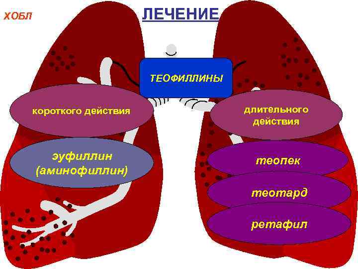 ЛЕЧЕНИЕ ХОБЛ ТЕОФИЛЛИНЫ короткого действия длительного действия эуфиллин (аминофиллин) теопек теотард ретафил 