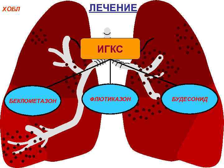 ХОБЛ ЛЕЧЕНИЕ ИГКС БЕКЛОМЕТАЗОН ФЛЮТИКАЗОН БУДЕСОНИД 