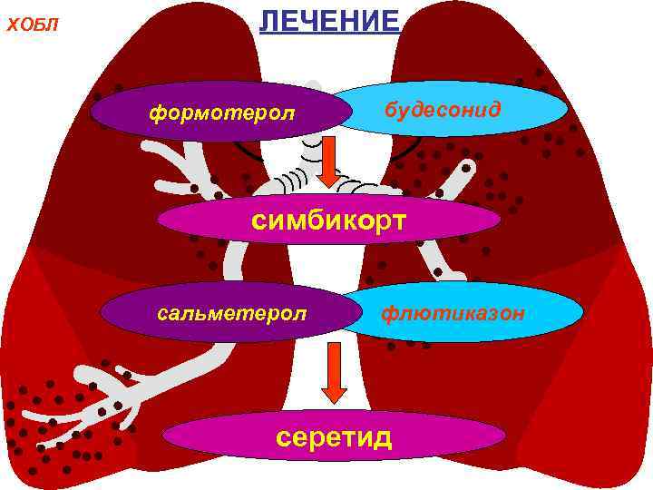 ХОБЛ ЛЕЧЕНИЕ формотерол будесонид симбикорт сальметерол флютиказон серетид 