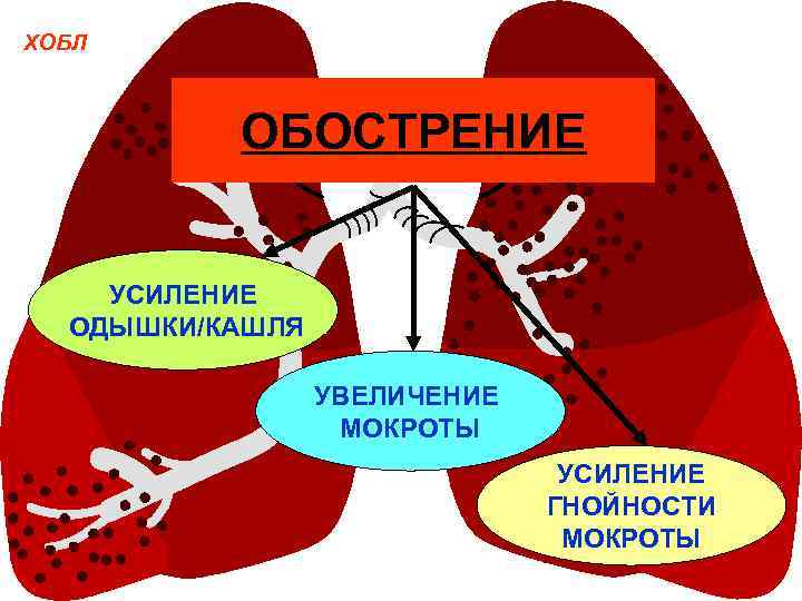 ХОБЛ ОБОСТРЕНИЕ УСИЛЕНИЕ ОДЫШКИ/КАШЛЯ УВЕЛИЧЕНИЕ МОКРОТЫ УСИЛЕНИЕ ГНОЙНОСТИ МОКРОТЫ 