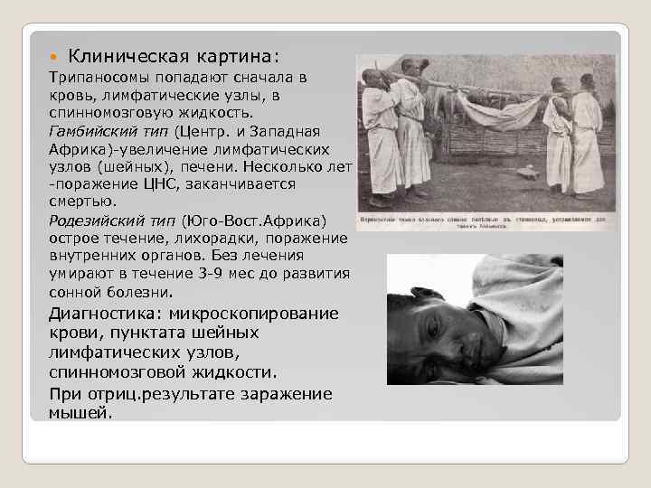 Клиническая картина: Трипаносомы попадают сначала в кровь, лимфатические узлы, в спинномозговую жидкость. Гамбийский