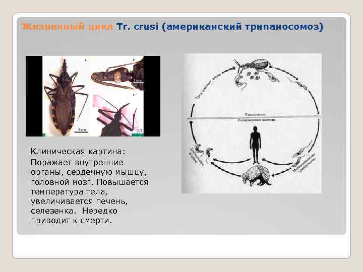 Жизненный цикл Tr. crusi (американский трипаносомоз) Клиническая картина: Поражает внутренние органы, сердечную мышцу, головной