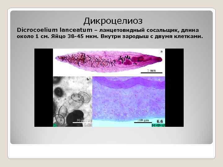 Дикроцелиоз Dicrocoelium lanceatum – ланцетовидный сосальщик, длина около 1 см. Яйцо 38 -45 мкм.