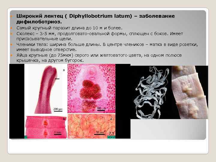  Широкий лентец ( Diphyllobotrium latum) – заболевание дифилоботриоз. Самый крупный паразит длина до