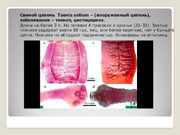 Свиной цепень Taenia solium – (вооруженный цепень), заболевания – тениоз, цистициркоз. Длина не более