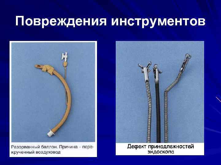 Повреждения инструментов 