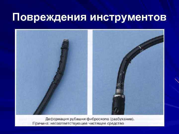 Повреждения инструментов 