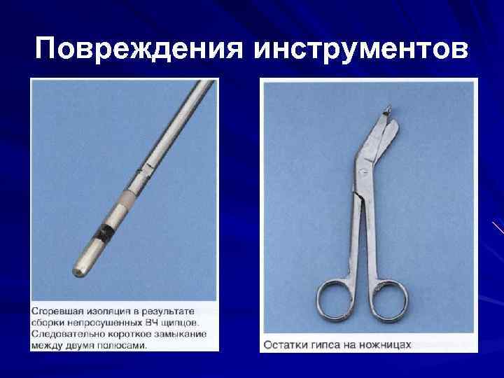 Повреждения инструментов 