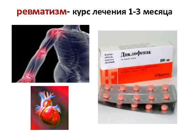  ревматизм- курс лечения 1 -3 месяца 