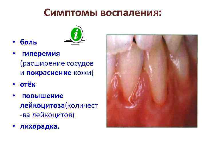 Симптомы воспаления: • боль • гиперемия (расширение сосудов и покраснение кожи) • отёк •