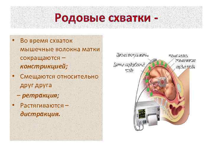 Родовые схватки • Во время схваток мышечные волокна матки сокращаются – констрикцией; • Смещаются