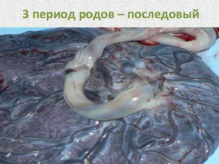 3 период родов – последовый 