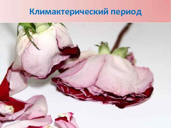 Климактерический период 