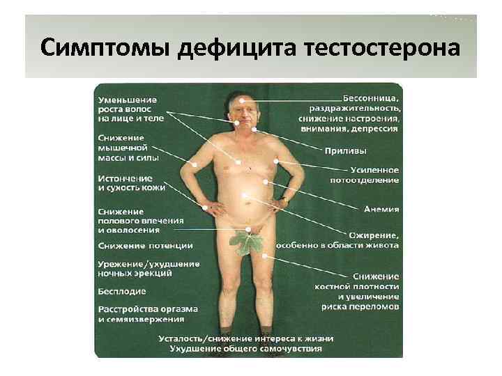 Симптомы дефицита тестостерона 