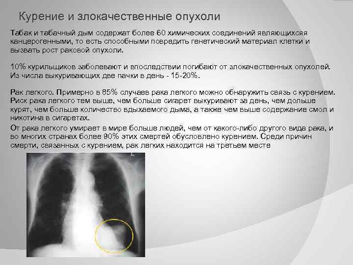 Курение и злокачественные опухоли Табак и табачный дым содержат более 60 химических соединений являющихсяя