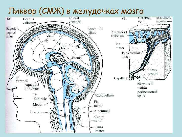 Ликвор (СМЖ) в желудочках мозга 