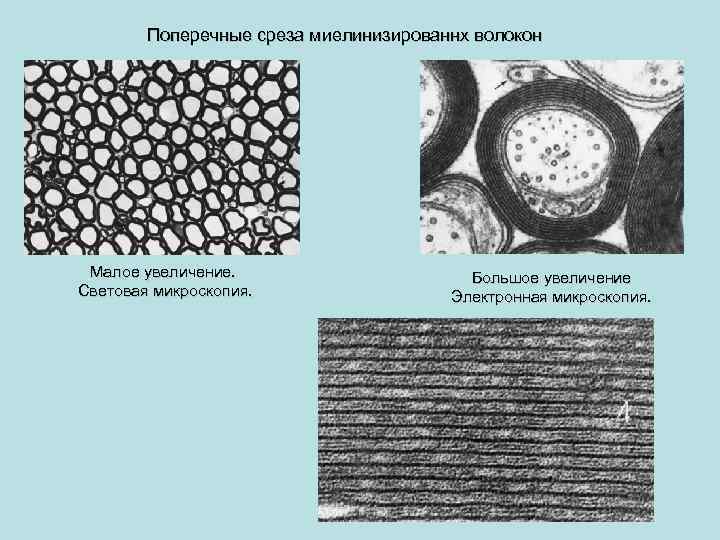 Поперечные среза миелинизированнх волокон Малое увеличение. Световая микроскопия. Большое увеличение Электронная микроскопия. 