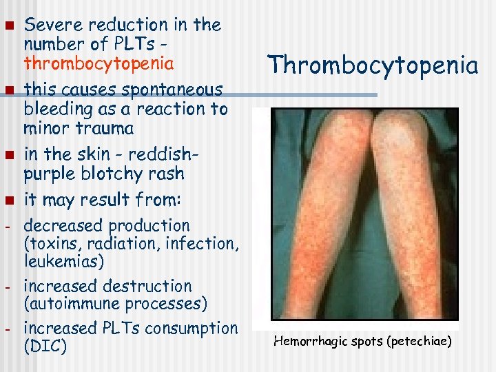 n n - - Severe reduction in the number of PLTs thrombocytopenia this causes