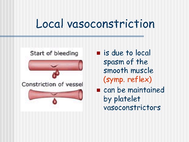 Local vasoconstriction n n is due to local spasm of the smooth muscle (symp.