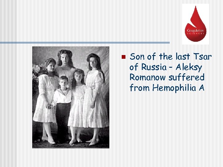 n Son of the last Tsar of Russia – Aleksy Romanow suffered from Hemophilia