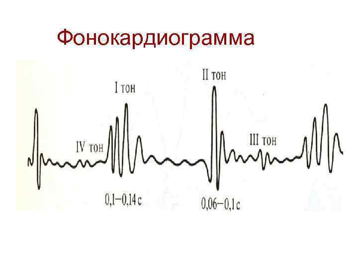 Фонокардиограмма 