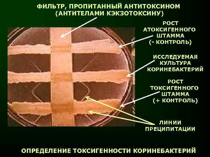 ФИЛЬТР, ПРОПИТАННЫЙ АНТИТОКСИНОМ (АНТИТЕЛАМИ КЭКЗОТОКСИНУ) РОСТ АТОКСИГЕННОГО ШТАММА (- КОНТРОЛЬ) ИССЛЕДУЕМАЯ КУЛЬТУРА КОРИНЕБАКТЕРИЙ РОСТ